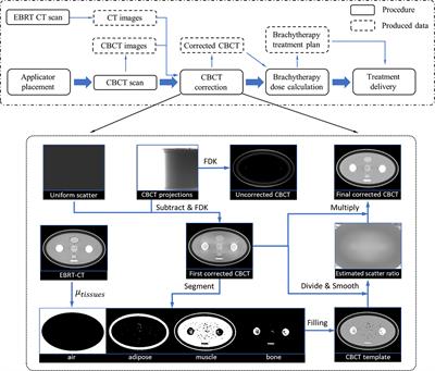 Development and validation of a scatter-corrected CBCT image-guided method for cervical cancer brachytherapy